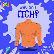 Bug Club Reading Corner: Age 5-7: Why Do I Itch?